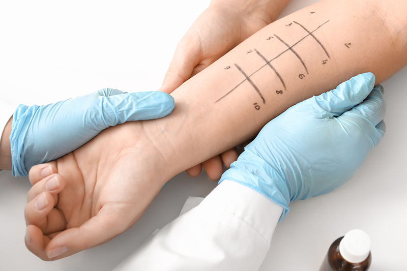 Allergy Testing / Immunotherapy